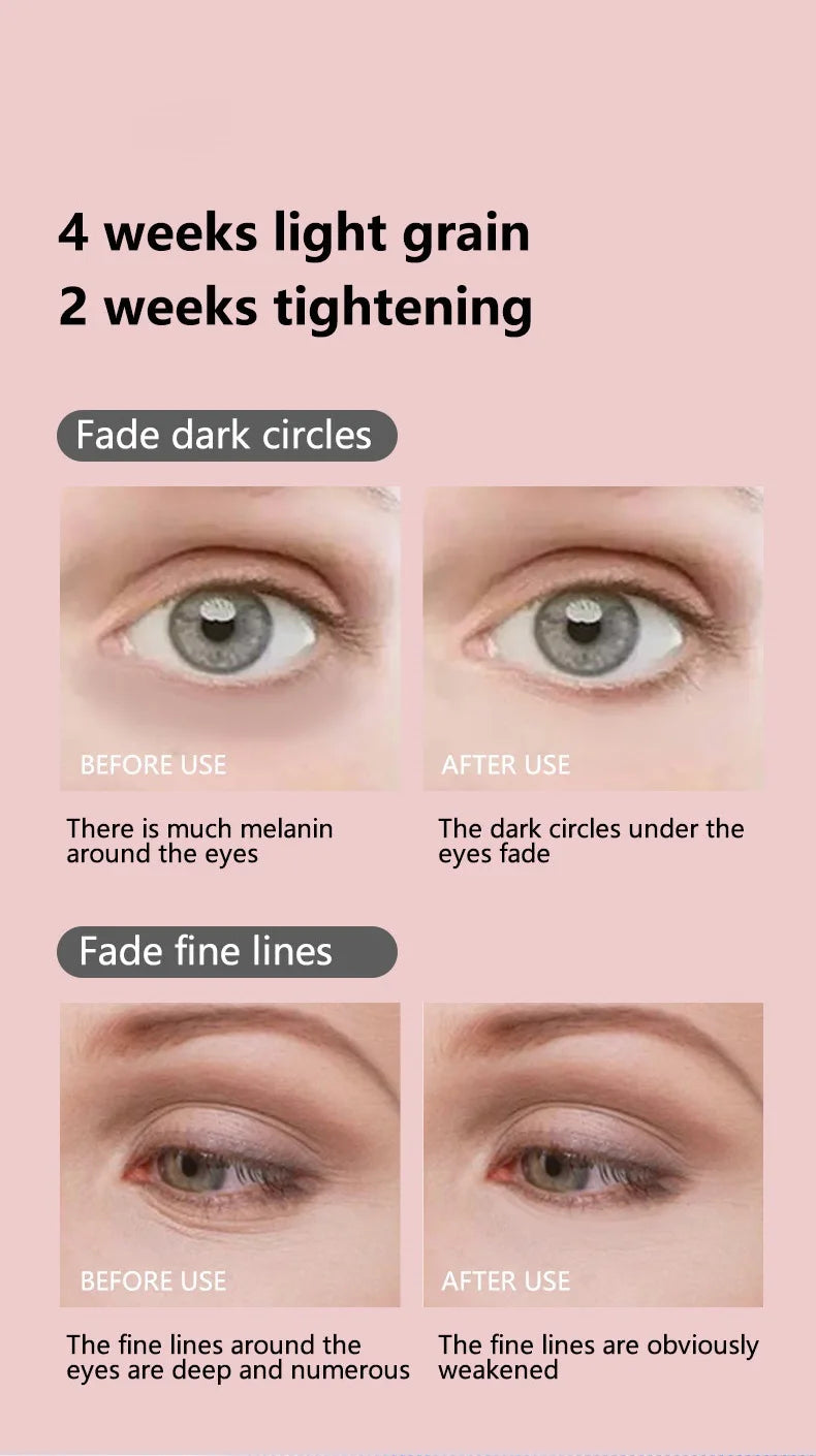 EMS Facial Lifter 🔴 Anti-Wrinkle & Skin Tightening